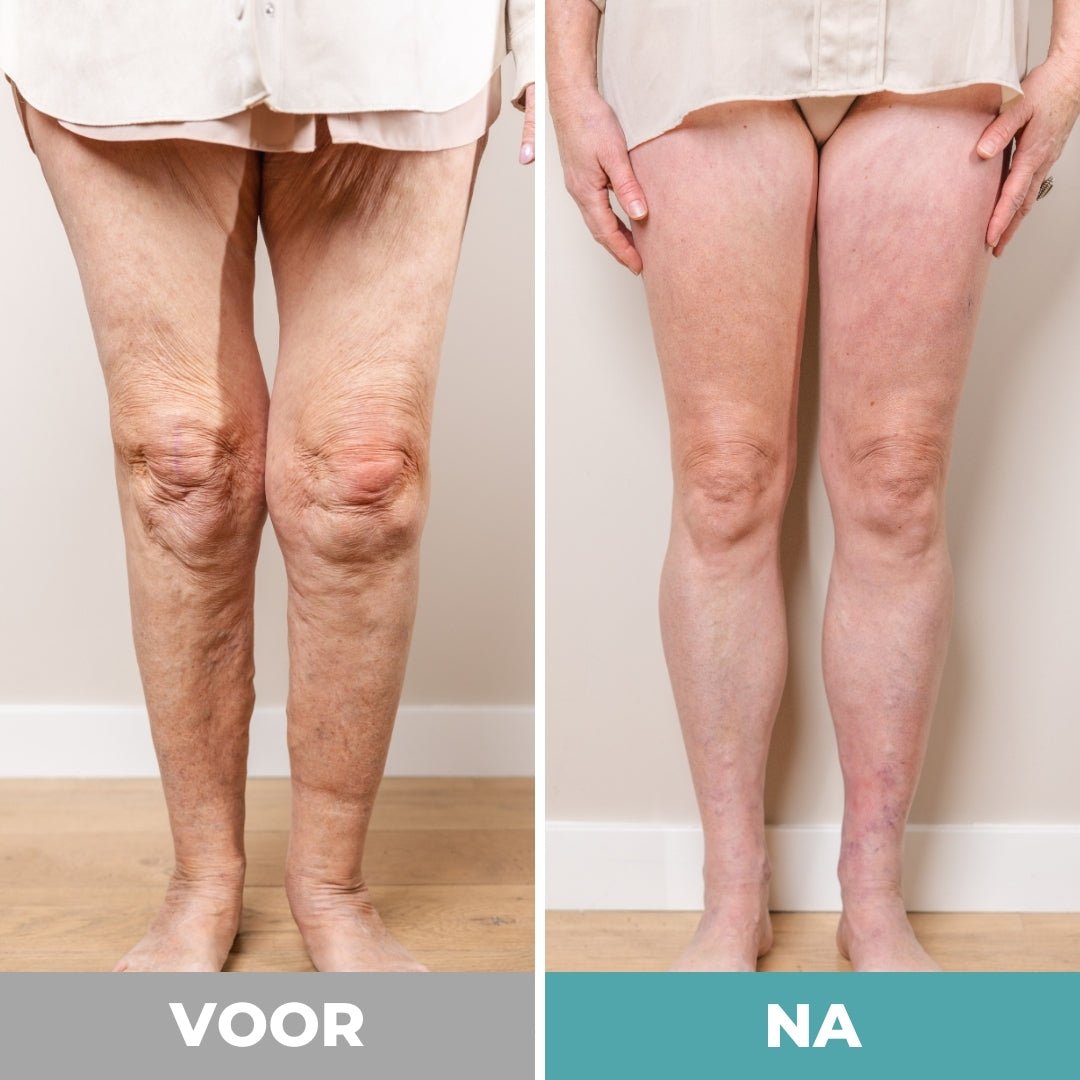 ReliveX™ Voetmassager - ReliveX